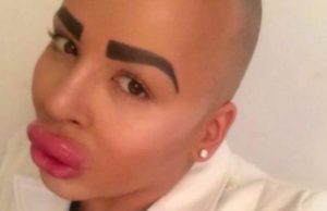 Se opera para parecerse a Kim Kardashian; pierde movilidad de su rostro