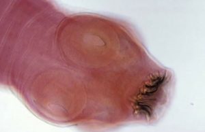 Doctores descubren un gusano que está Invadiendo tu cerebro por comer este alimento que es tan común. !Te Sorprenderá!