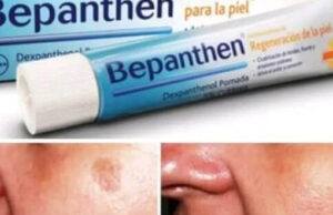 Para que sirve la crema Bepanthen