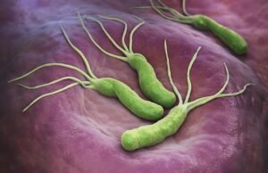 Médico japonés filtra remedio natural para acabar con la bacteria helicobacter pylori