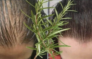 Mascarilla de romero para hacer crecer el cabello mucho más rápido